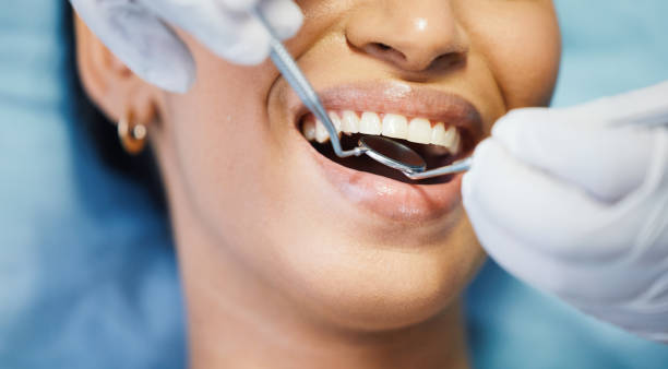 Best Emergency Dentist for Lost Fillings or Crowns in Fayetteville, NY