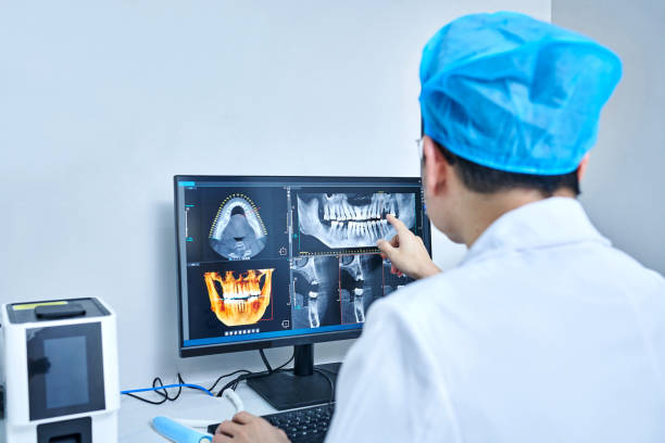 Best Broken or Cracked Tooth Emergency Dentist in Fayetteville, NY